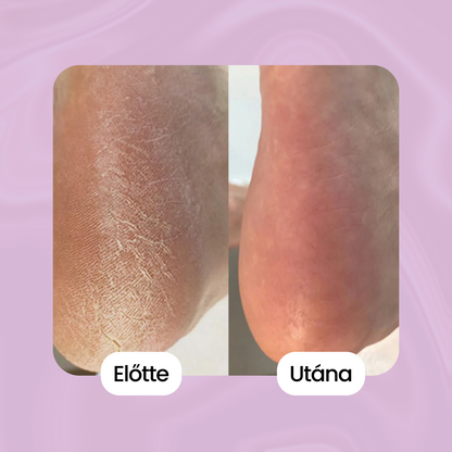 Selyemlux - Bőrsimító 2.0